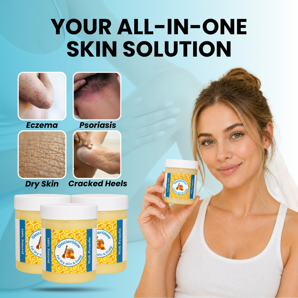 GlacierGlow - Steroid Free Balm For Eczema & Psoriasis
